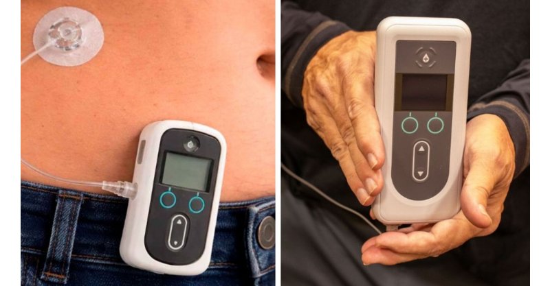 Anvisa libera novo produto para quem não responde aos tratamentos convencionais de Parkinson