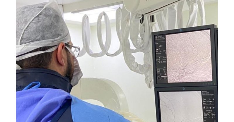 Criciúma / HSJosé / tratamento inovador para doenças cerebrovasculares é realizado pela primeira vez em Santa Catarina