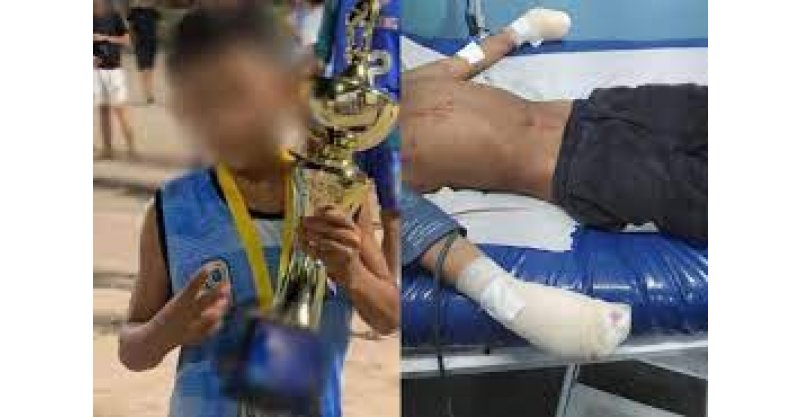 Homem tem dedos decepados após furto em Laguna; caso gera revolta
