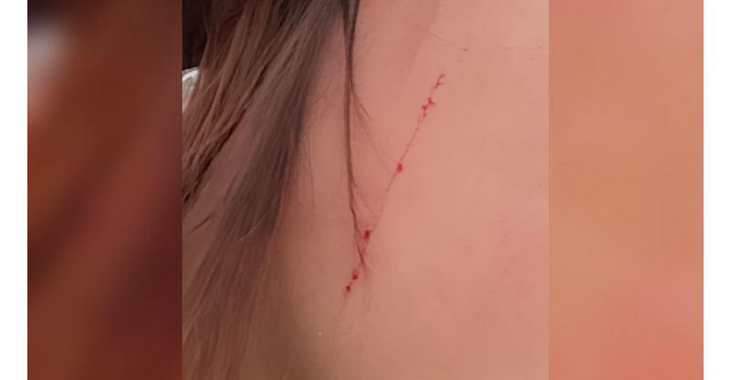 IMBITUBA / Jovem é assediada e agredida no centro do município ao sair do trabalho