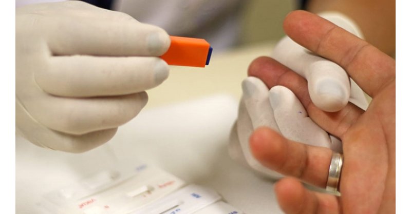 Jovens ainda concentram maior número de casos de HIV
