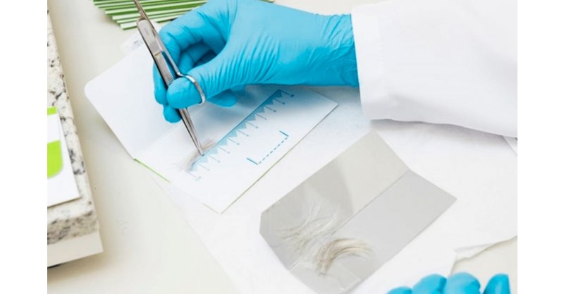 Prefeitura de Imbituba abre credenciamento de laboratórios para realização de exames toxicológicos