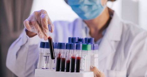 Exame de sangue detecta Alzheimer em descoberta de cientistas brasileiros