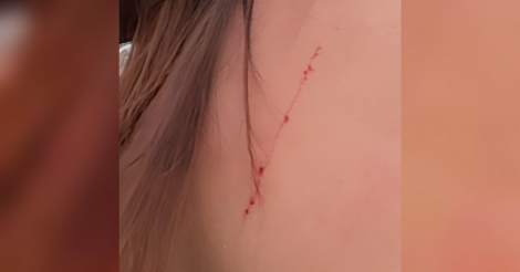 IMBITUBA / Jovem é assediada e agredida no centro do município ao sair do trabalho