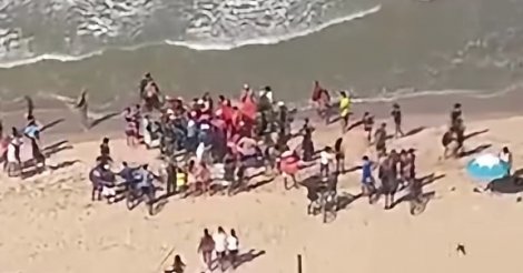 Menino de 11 anos é mordido por tubarão em praia de Pernambuco e passa por cirurgia no hospital